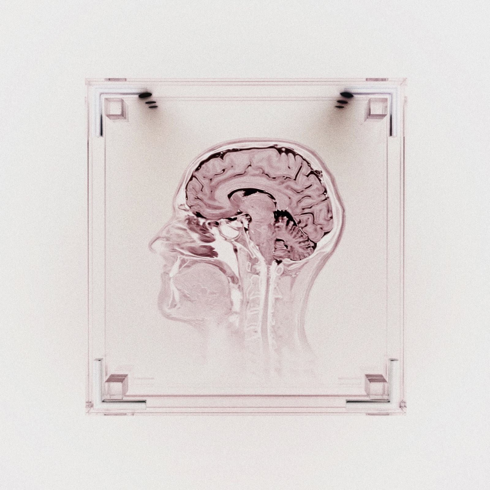 Rebirth CD DELUXE [Signed]